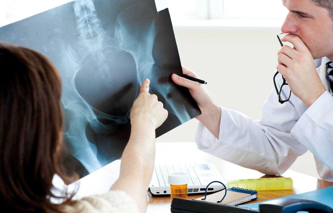 doctors examining an x-ray for osteoarthritis of the hip