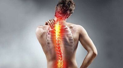 Back pain symptoms